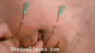 নষ্ট কুক্কুট ম্যাডি  ...